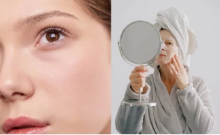 Desfrute de uma pele radiante e livre de acne com essas dicas de cuidados e prevenção. Cuide da sua pele, cuide de você!