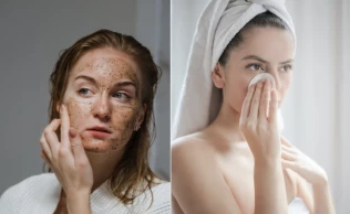 Ao optar por receitas caseiras, você evita a exposição a produtos químicos agressivos que podem estar presentes em muitos produtos comerciais de cuidados com a pele.